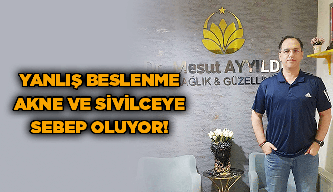 Yanlış Beslenme Akne ve Sivilceye Sebep Oluyor!