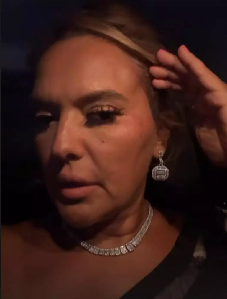 Demet Akalın Tekne Kazası Geçirdi! Demet Akalın Tekne Kazası Geçirdi!