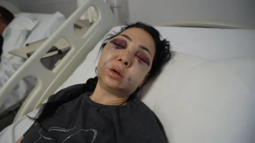 Anne ve Oğlunu Darp Eden 3 Şüpheliden 1’i Tutuklandı