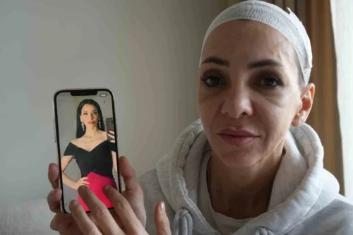 Kocaeli’de Eğlence Mekanı Kabusu: Anne ve Oğluna Feci Darp Sonrası Kadın “Asla Eskisi Gibi Olamayacağım” Dedi