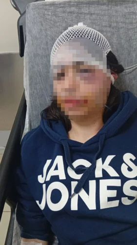 Kocaeli Körfez’de Ayrılmak İsteyen Sevgilisini Darp Eden Sanığın Tutukluluğu Sürüyor