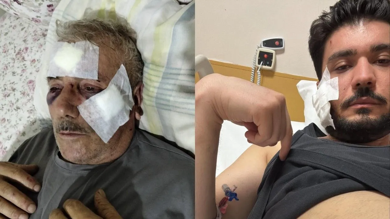 İzmit’teki kavgada B.K.: Annem bıçağa siper oldu