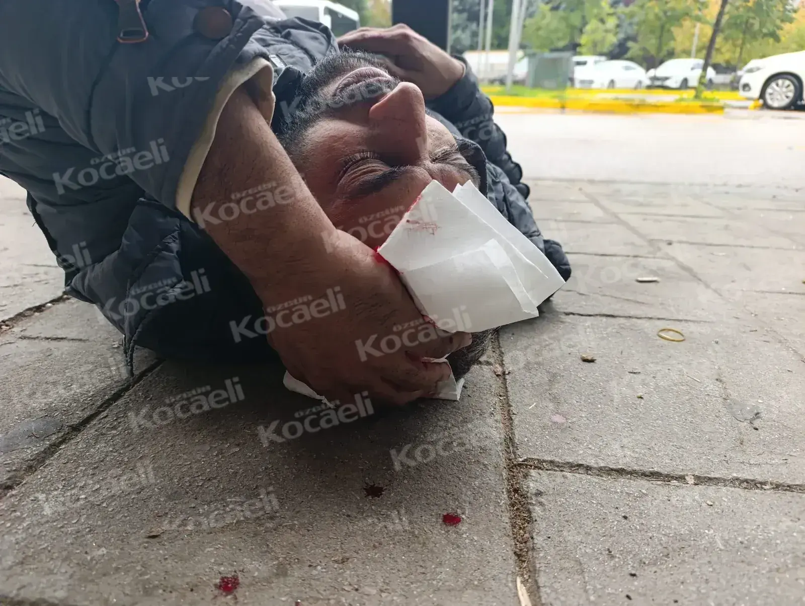 Otopark bariyeri başına çarptı, talihsiz adam hastanelik oldu